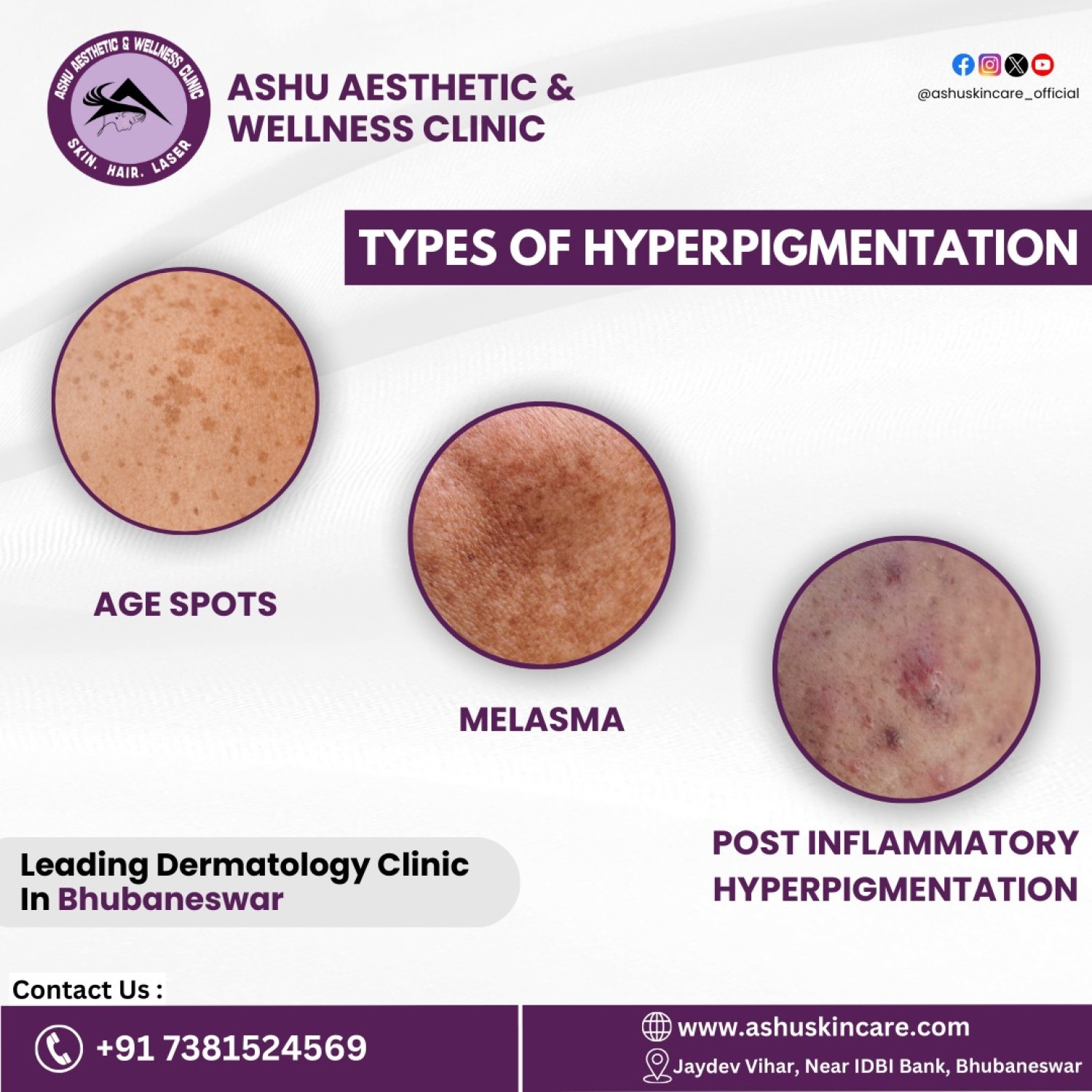 dermatologist-in-bhubaneswar-odisha-skin-doctor-in-bhubaneswar