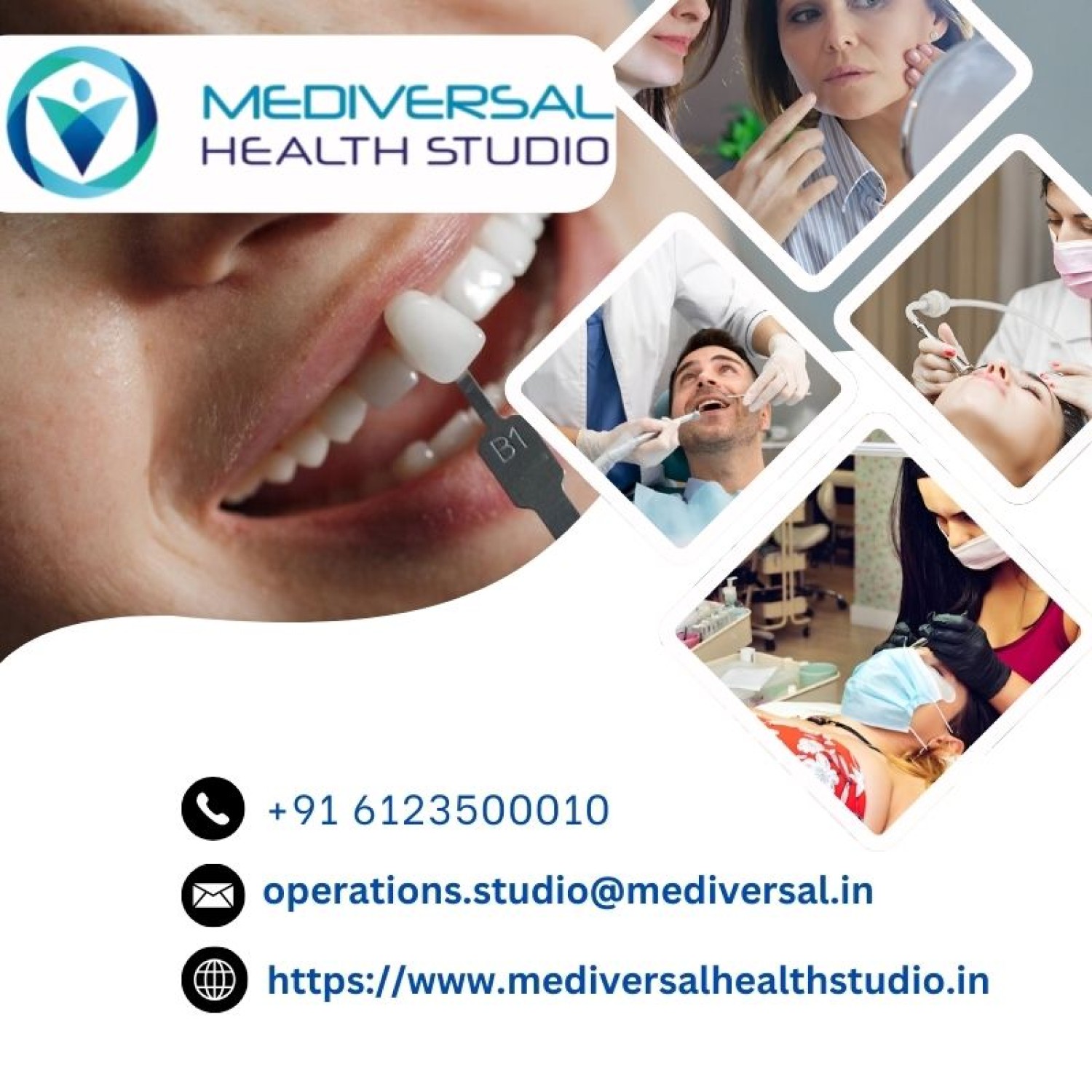 teeth-whitening-services-in-patna