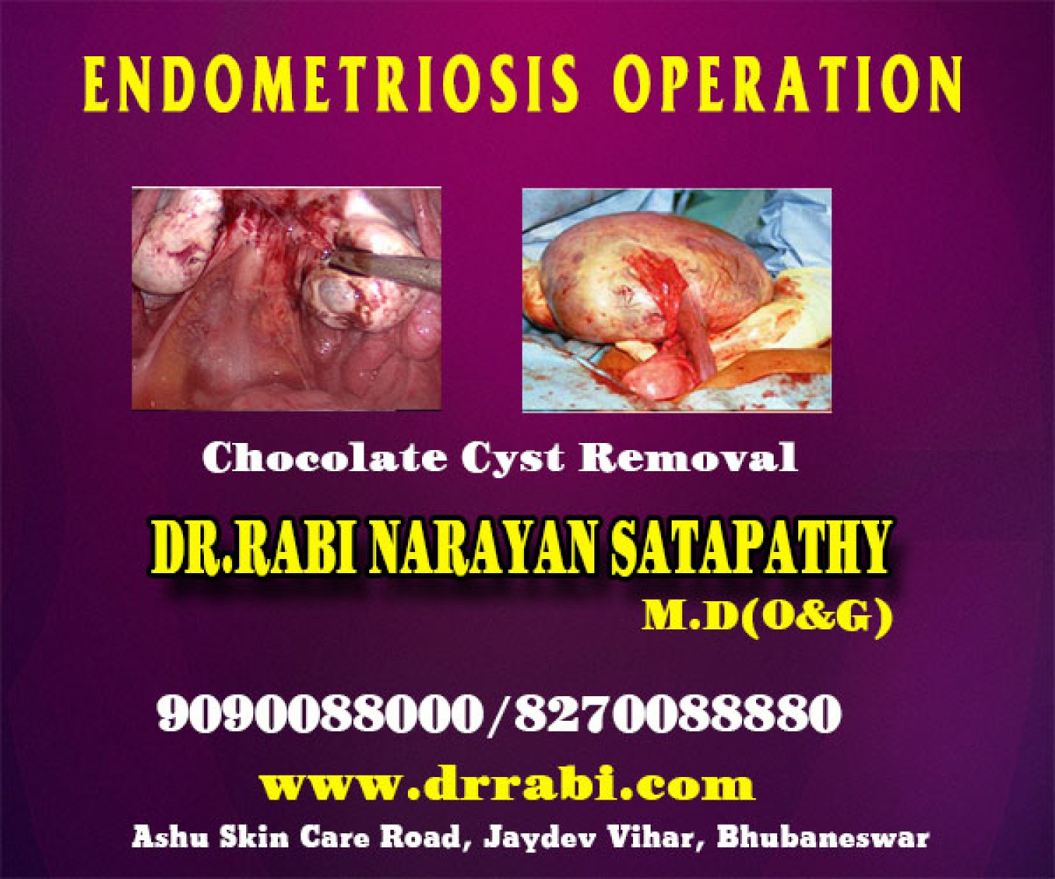 hymenoplasty-clinic-in-bhubaneswar-obstetrician-infertility-specialist-doctor-in-bhubaneswar