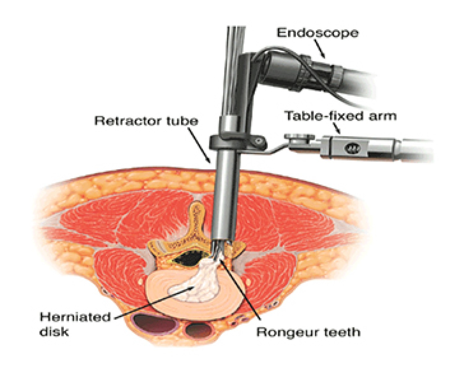 best-spine-surgoen-in-noida