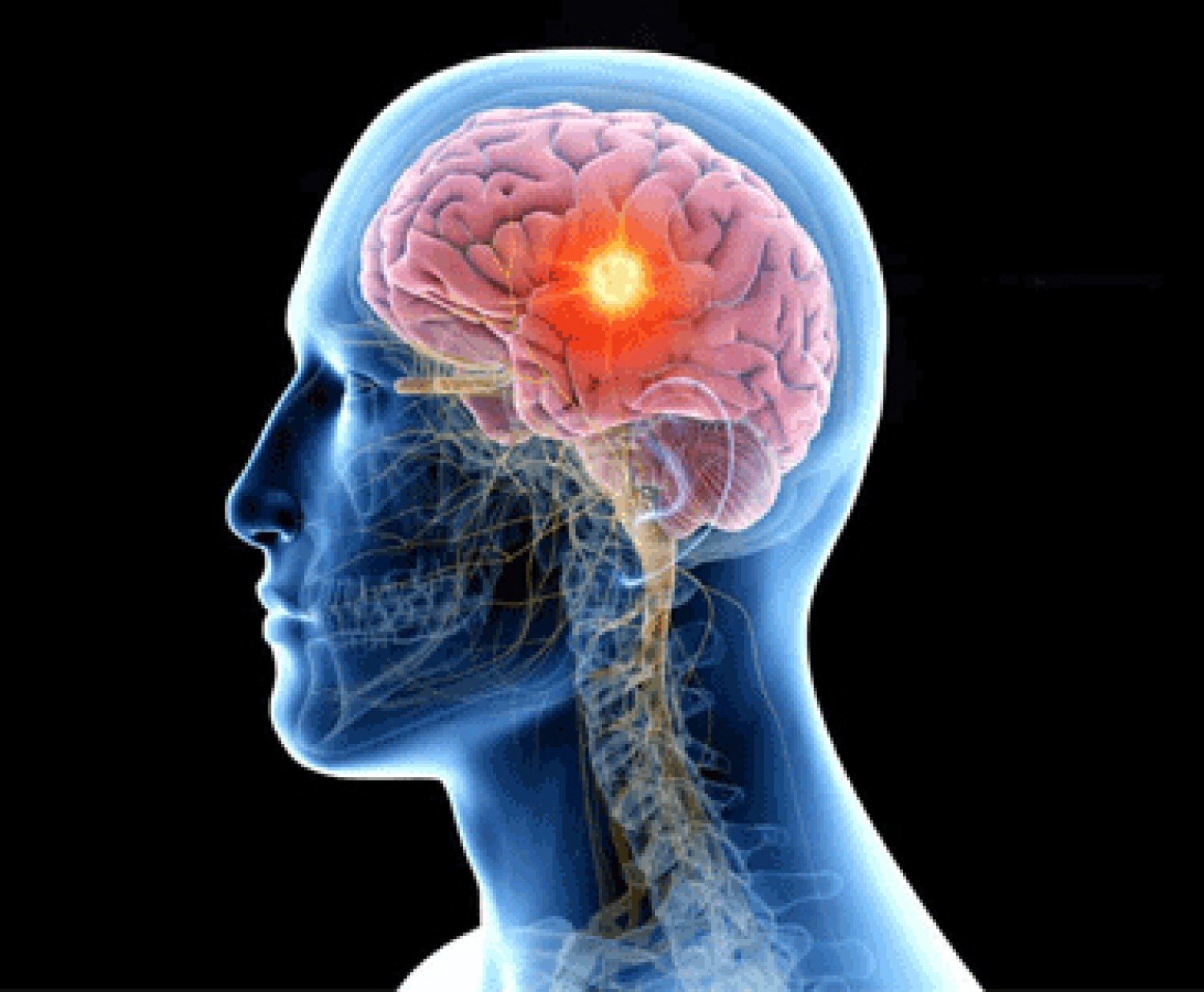 best-neurosurgeon-in-ghaziabad