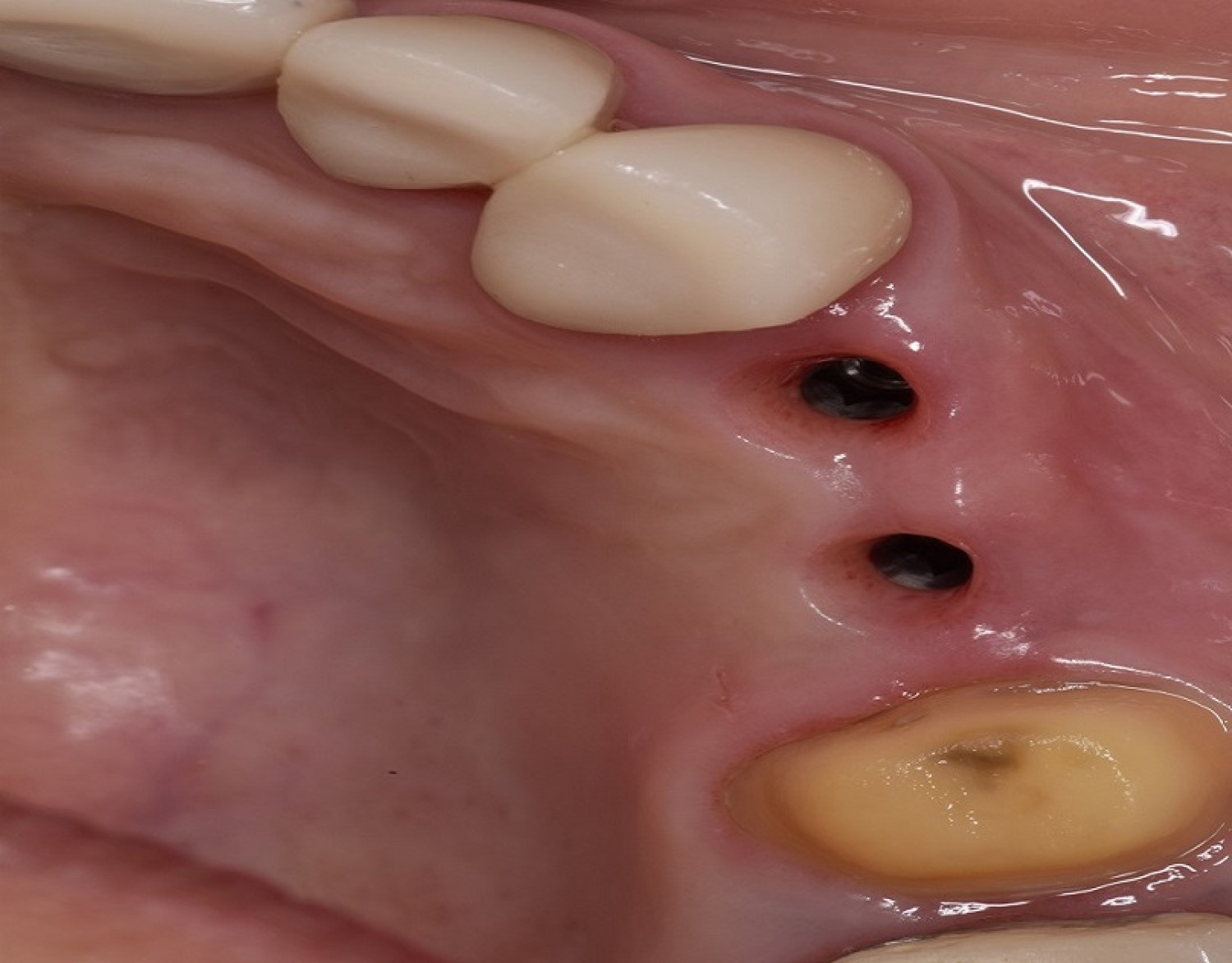 revive-your-natural-and-flawless-smiles-with-holistic-dental-care-in-tijuana