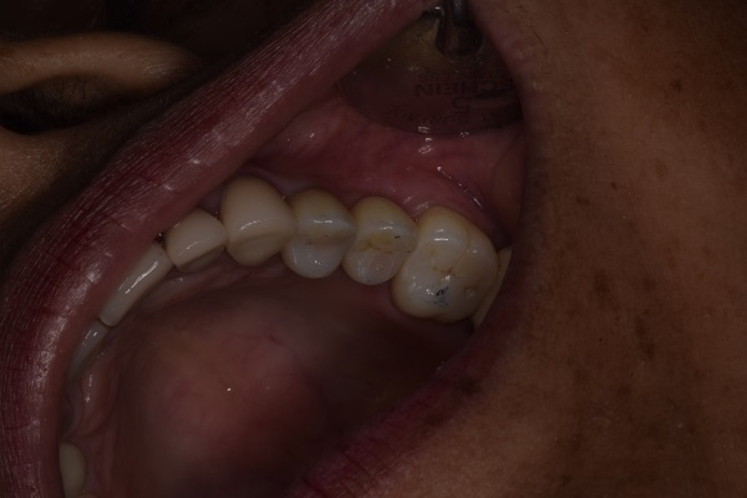 holistic-dentist-in-mexico-natural-biocompatible-care-for-your-health-and-smile