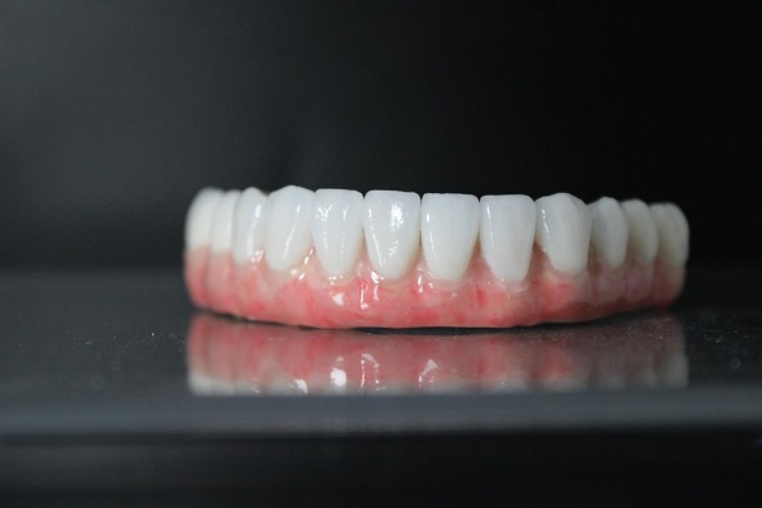 full-mouth-dental-implants-in-mexico-with-teeth-savers