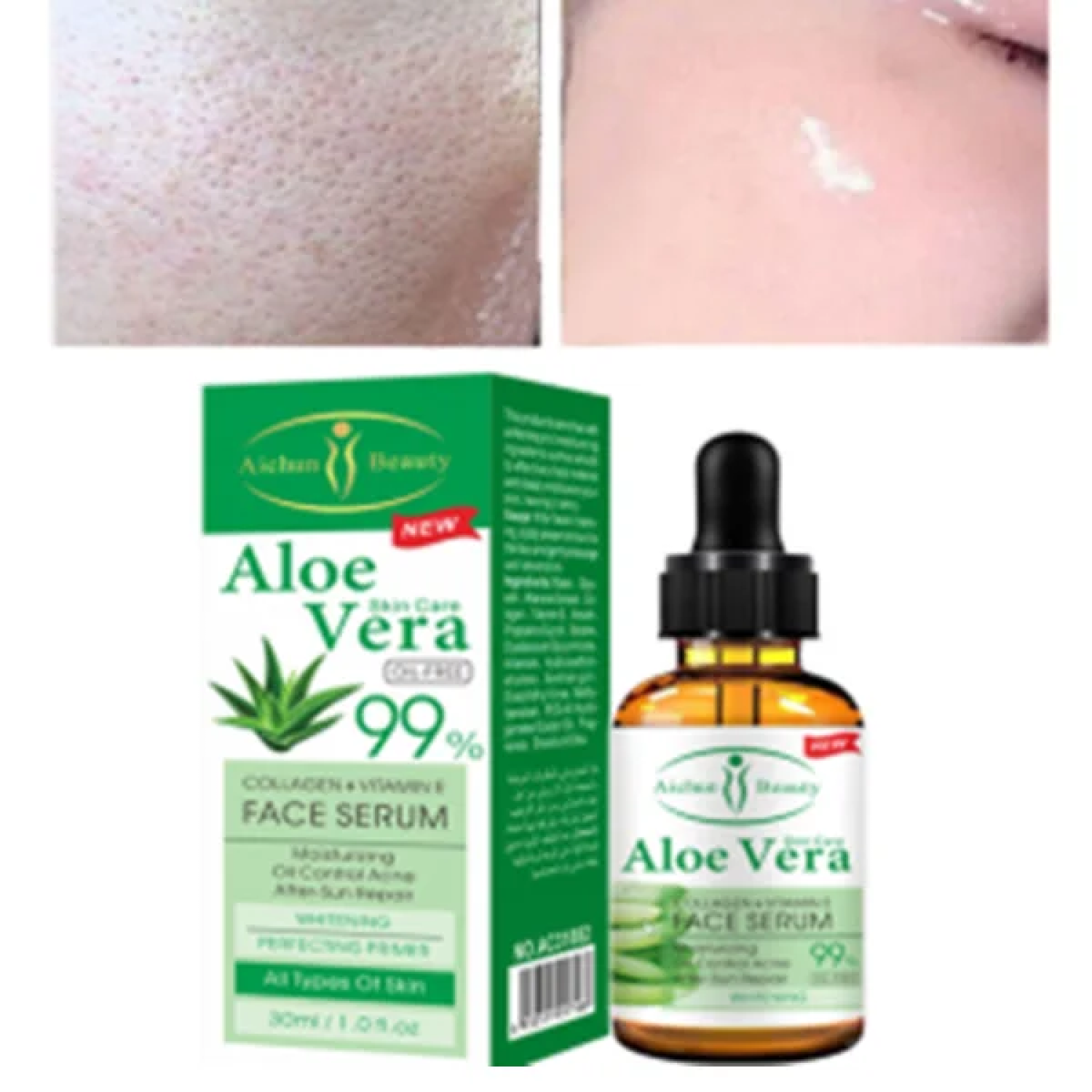 aloe-vera-whitening-serum-in-pakistan-aichun-beauty-anti-acne-face-serums-03000479274