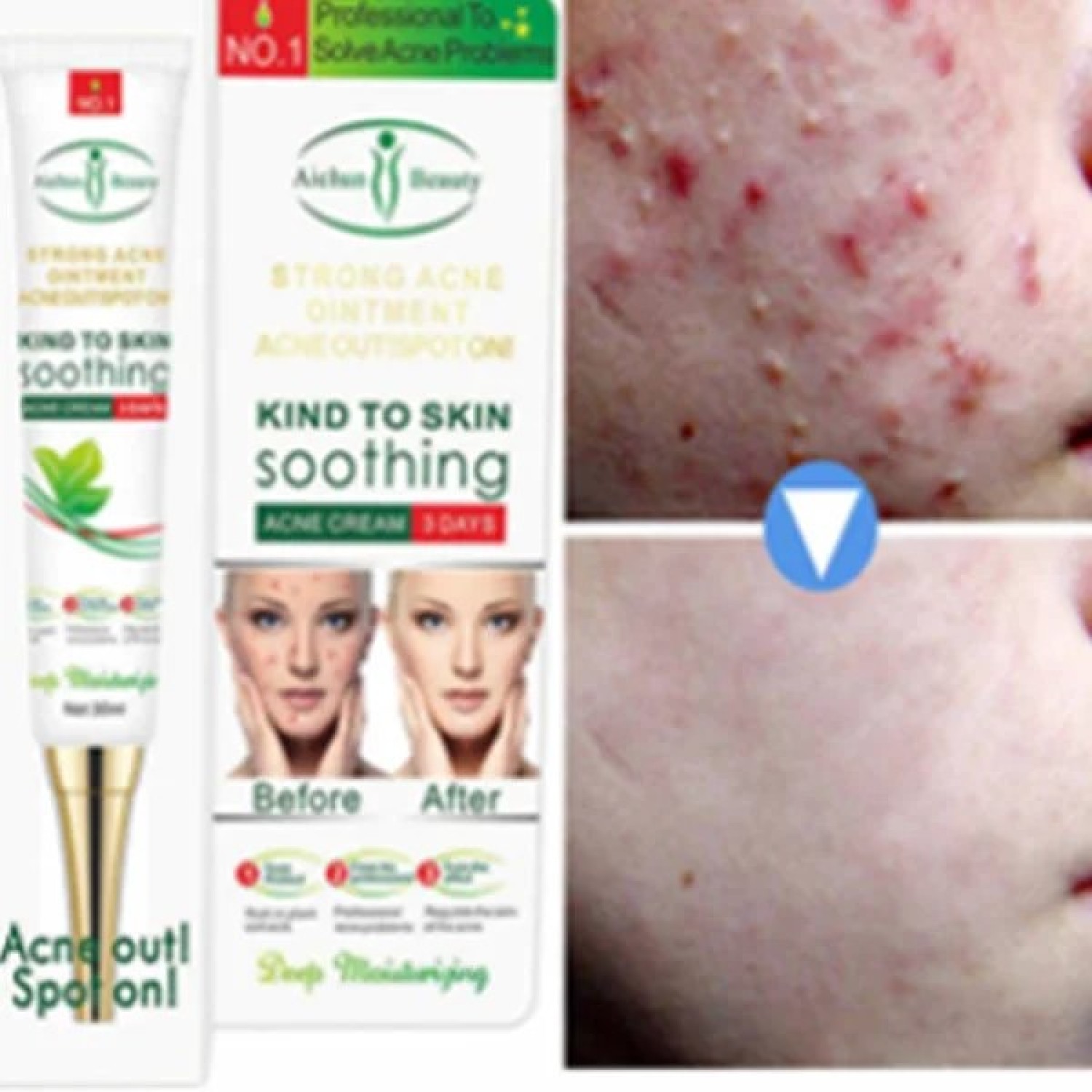 acne-freckle-cream-in-pakistan-medicated-cream-for-freckles-aichun-beauty-03000479274