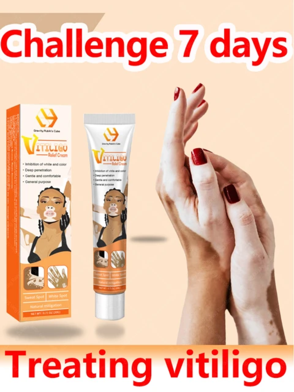 vitiligo-ointment-remove-ringworm-ship-mart-treatment-cream-03208727951