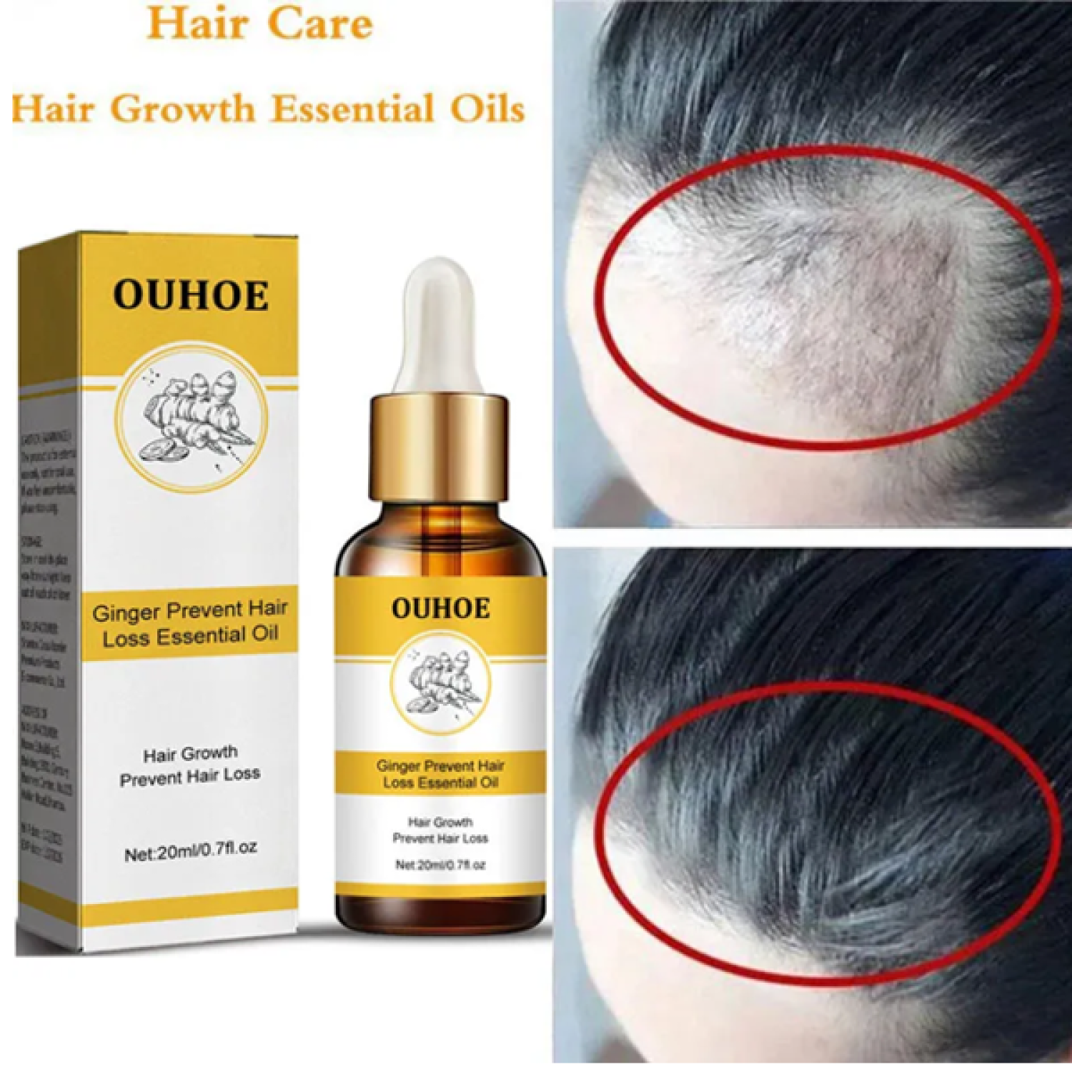 ouhoe-ginger-prevent-hair-loss-essential-oil-in-pakistan-wellmart-923208727951