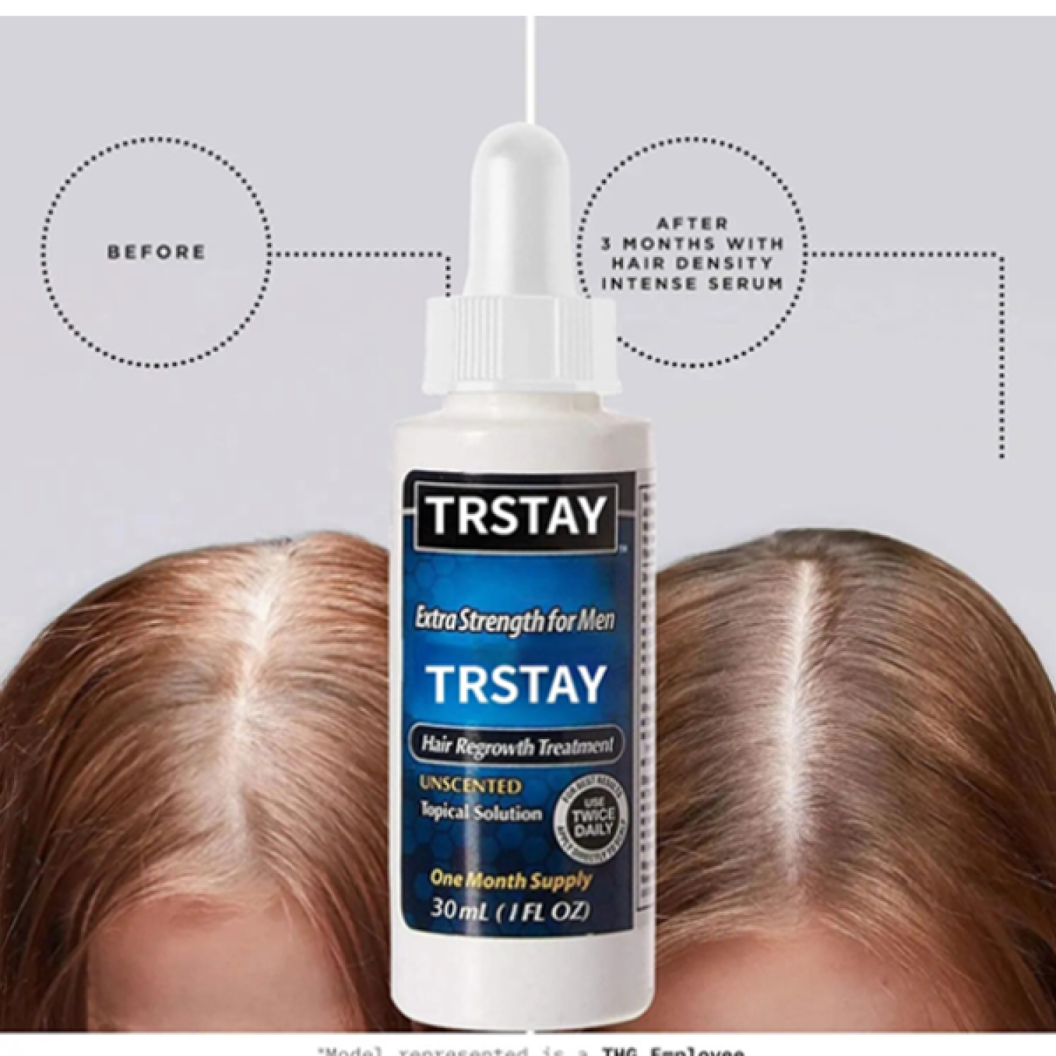 trstay-hair-regrowth-treatment-oil-in-pakistan-wellmart-923208727951