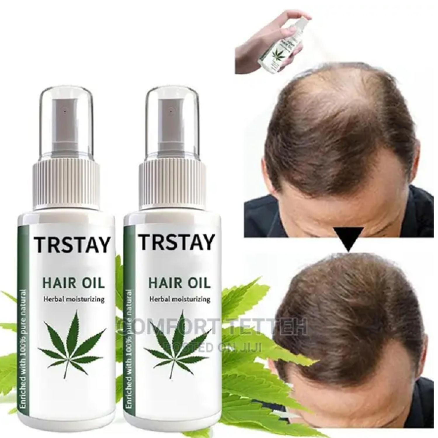 trstay-hair-oil-herbal-mostarzing-in-pakistan-wellmart-923208727951
