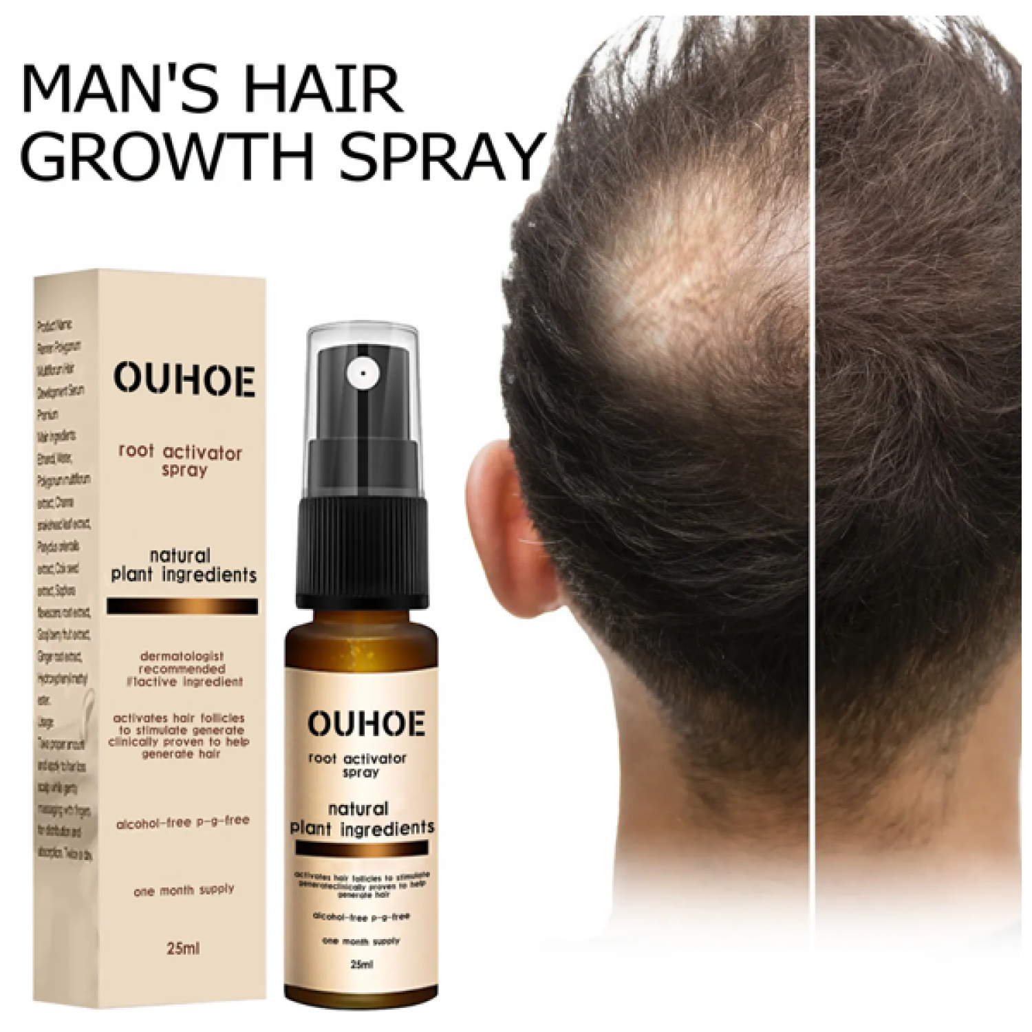 ouhoe-root-activator-hair-spray-in-pakistan-wellmart-923208727951