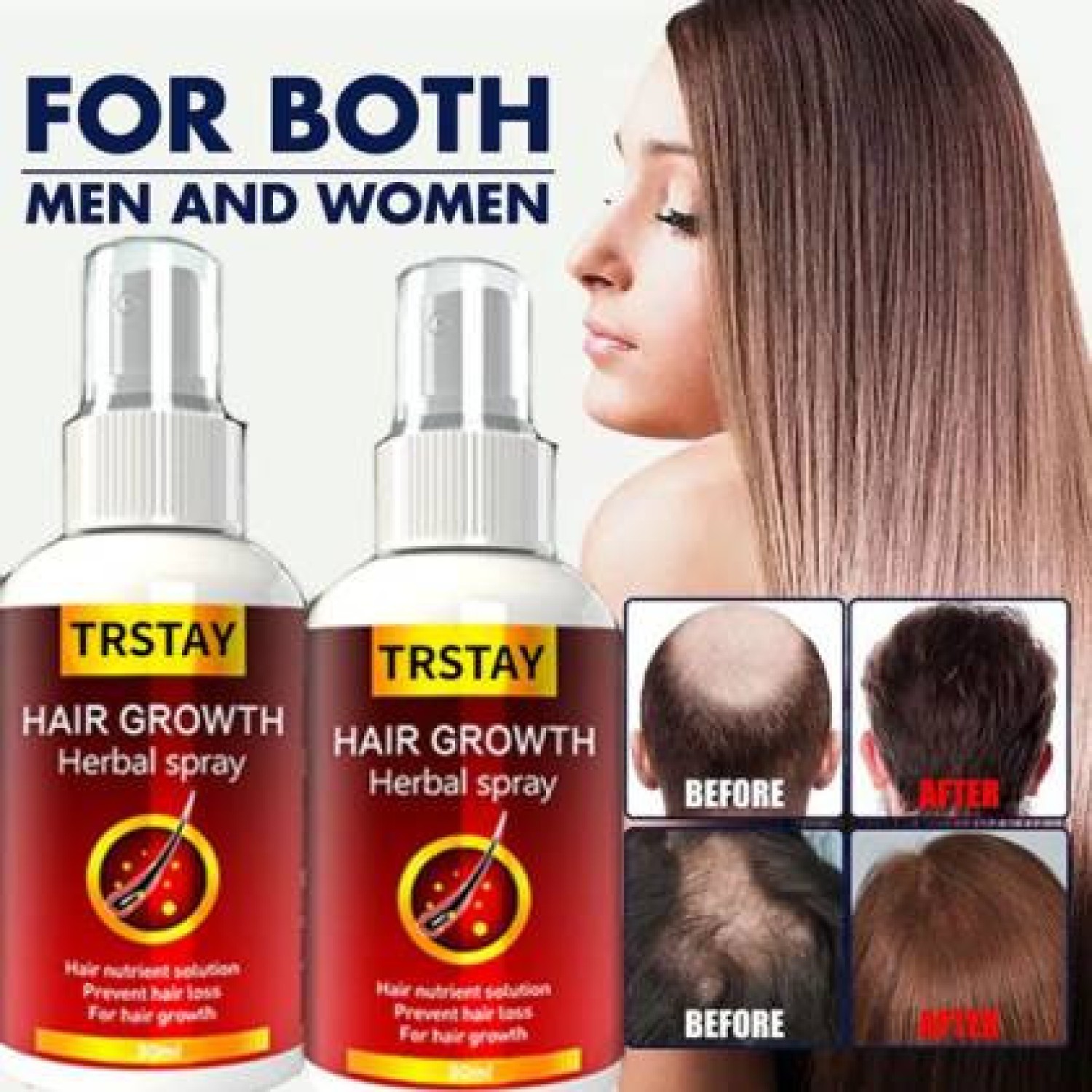 trstay-hair-growth-herbal-spray-in-pakistan-wellmart-923208727951