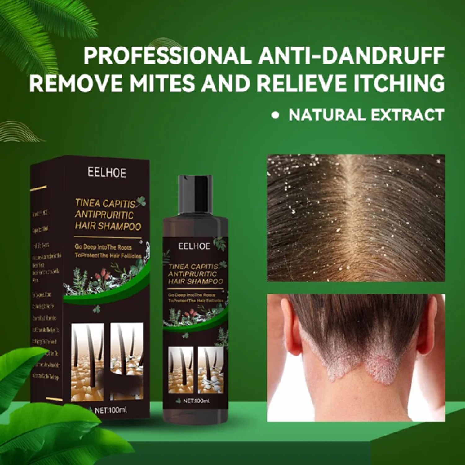 eelhoe-anti-dandruff-shampoo-in-pakistan-wellmart-923208727951