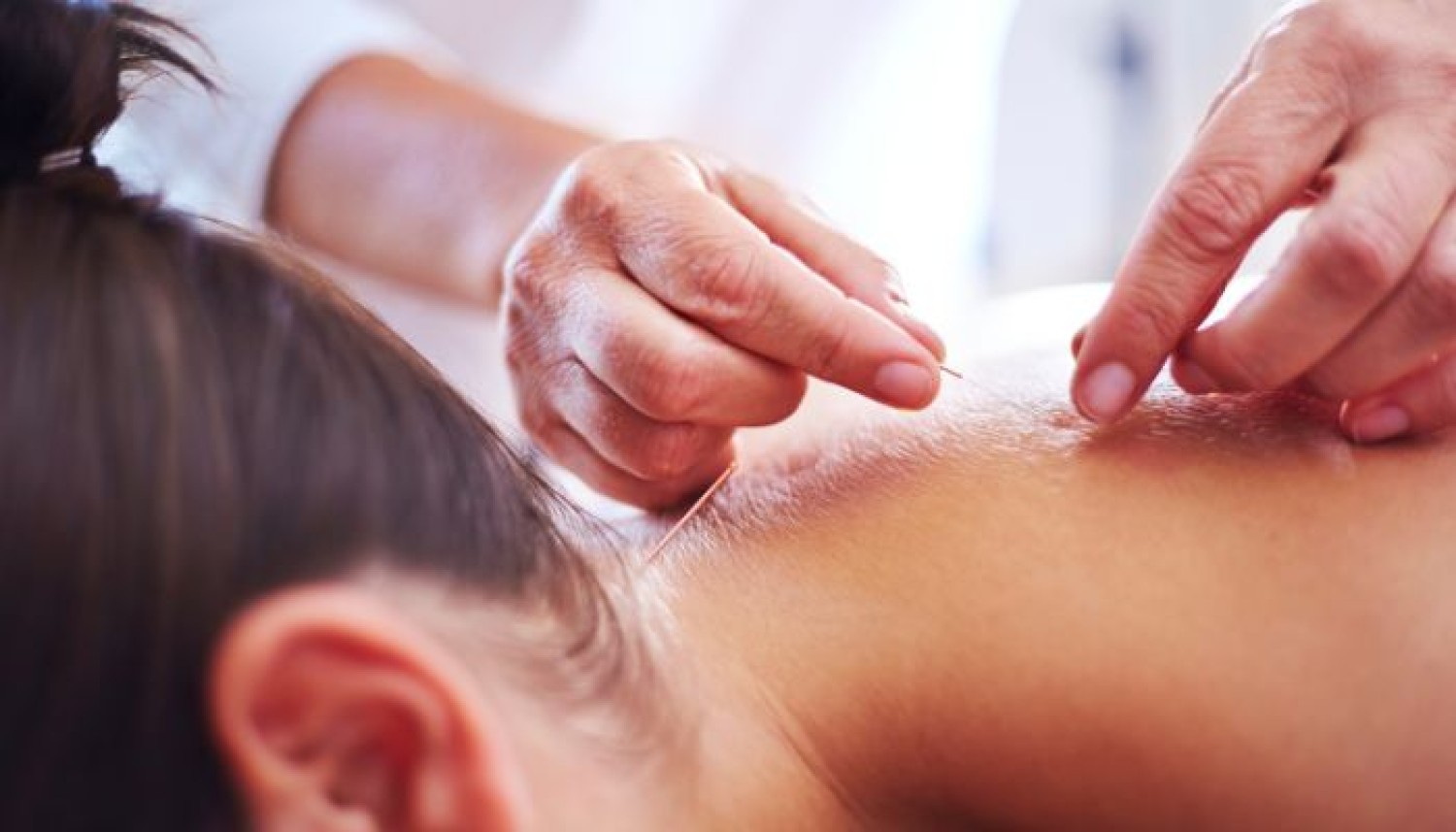 acupuncture-for-ivf-support