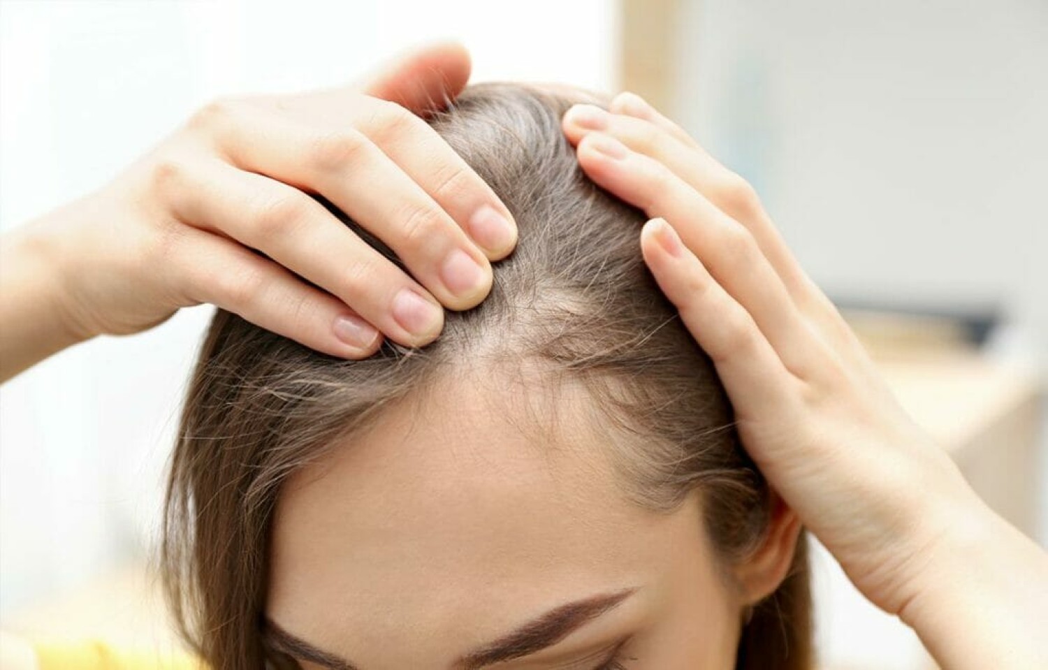 dallas-hair-loss-solutions